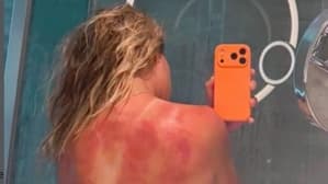 خطرات جدی برای بازیکنان تنیس زیر آفتاب شدید؛ ضرورت مراقبت جدی در برابر اشعه UV